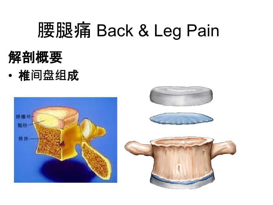 腰腿痛和颈肩痛PPT课件_第4页