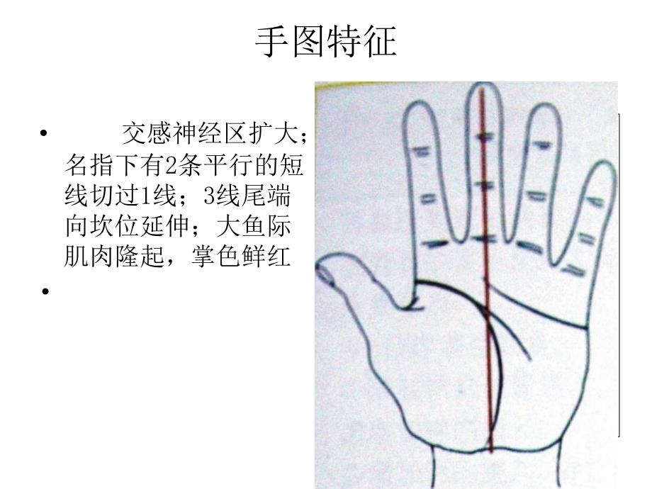 慢性疾病手诊2_第4页