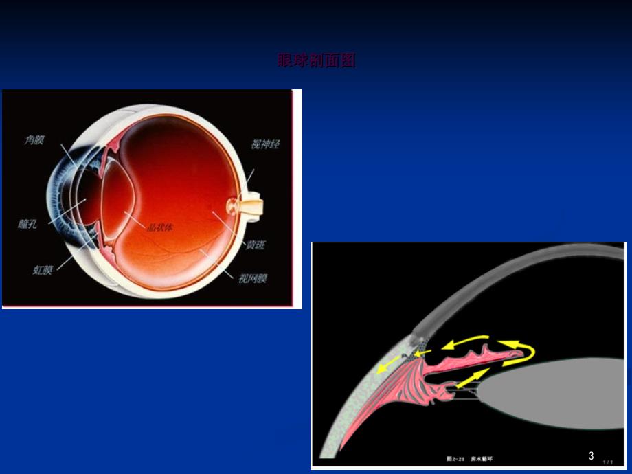 急性闭角型青光眼的诊断与治疗ppt课件_第3页