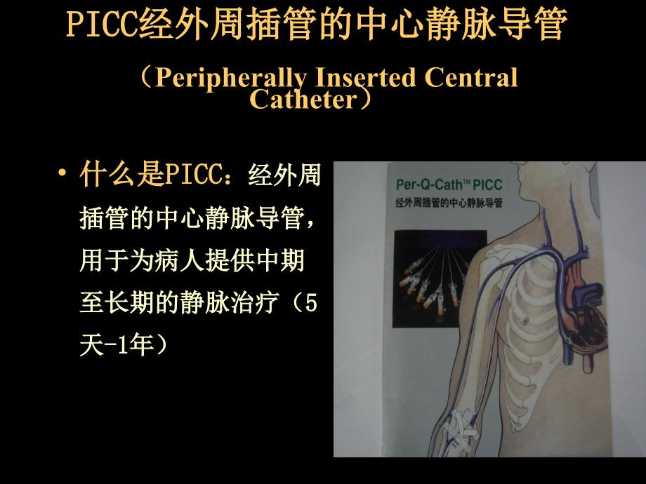 picc置管术及护理郭梅_第2页