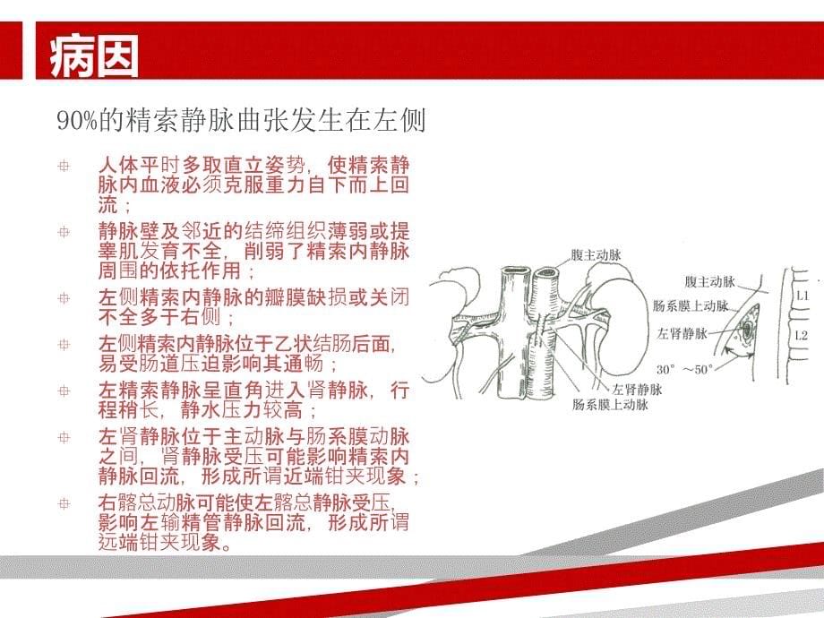 精索静脉曲张诊疗指南课件_第5页