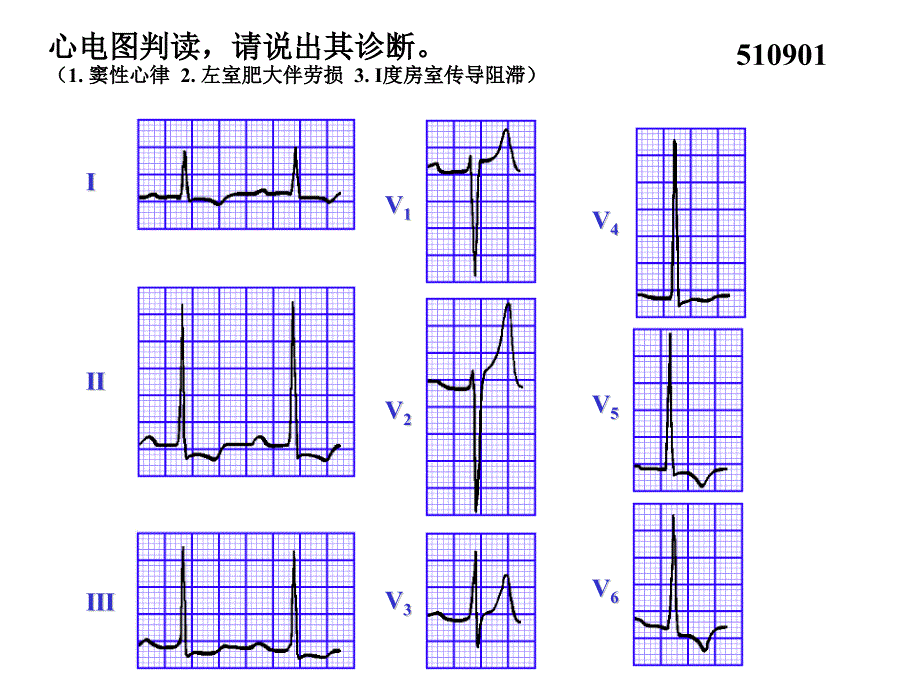 心电图试题及答案_第1页