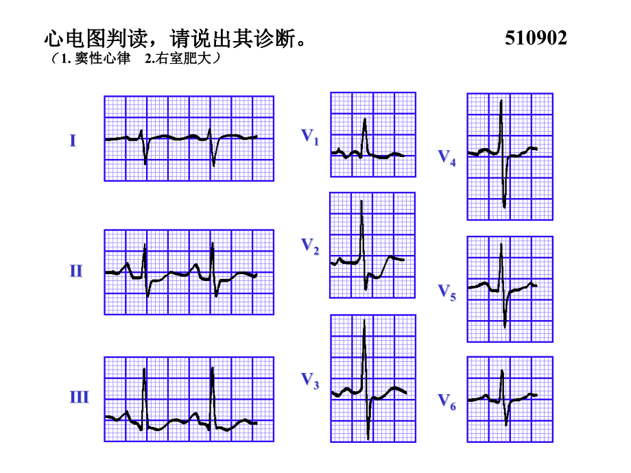 心电图试题及答案_第2页