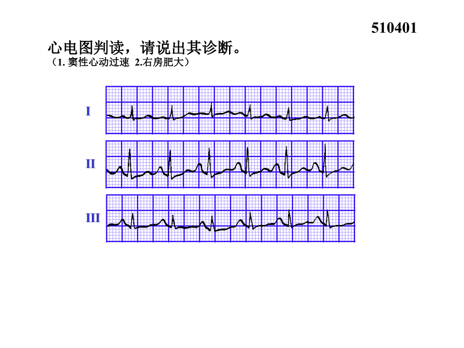 心电图试题及答案_第4页