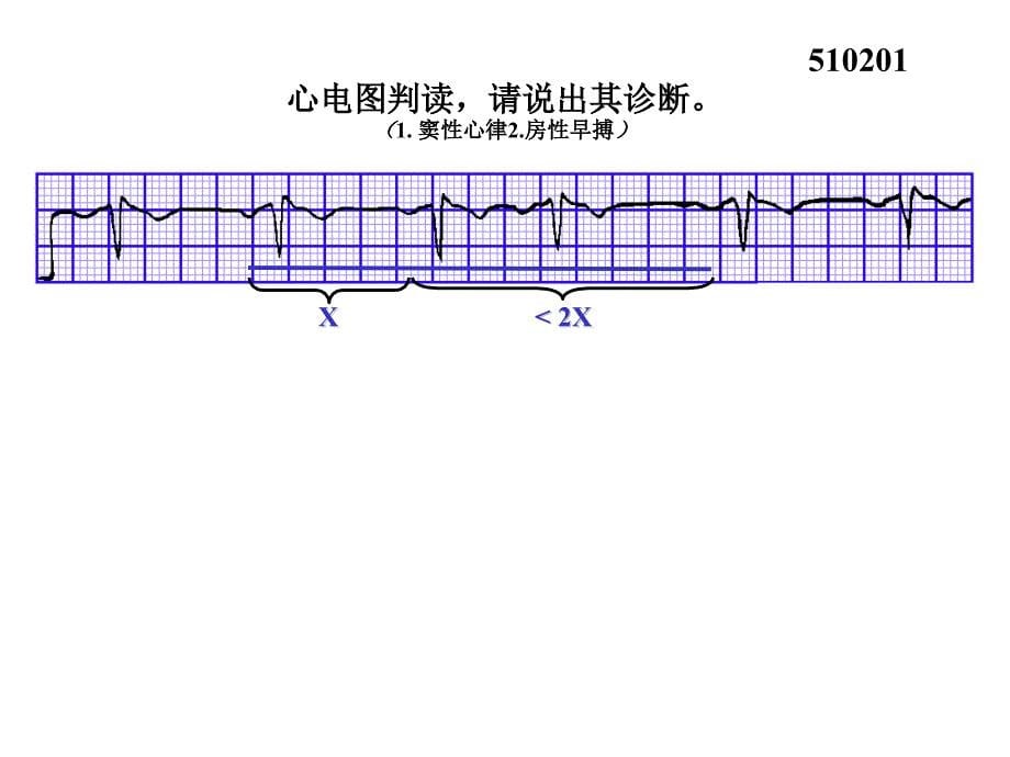 心电图试题及答案_第5页