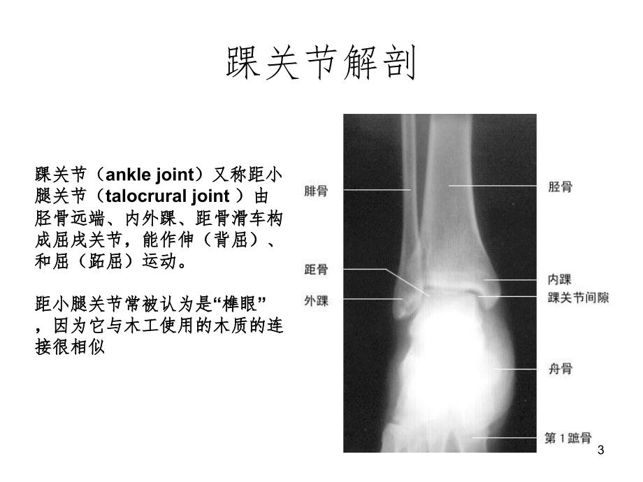 踝关节扭伤SprainedanklePPT精选文档_第3页