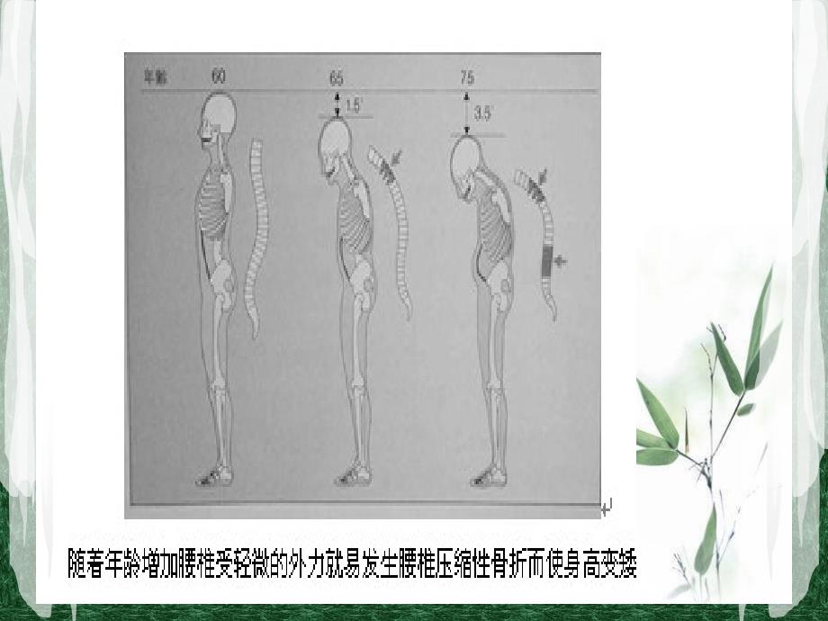 骨质疏松的健康教育_第4页