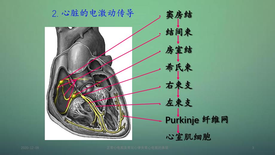 正常心电图及常见心律失常心电图的表现_第3页