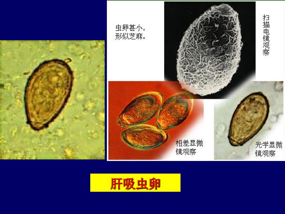 肝吸虫、姜吸虫及肝片吸虫PPT课件_第4页