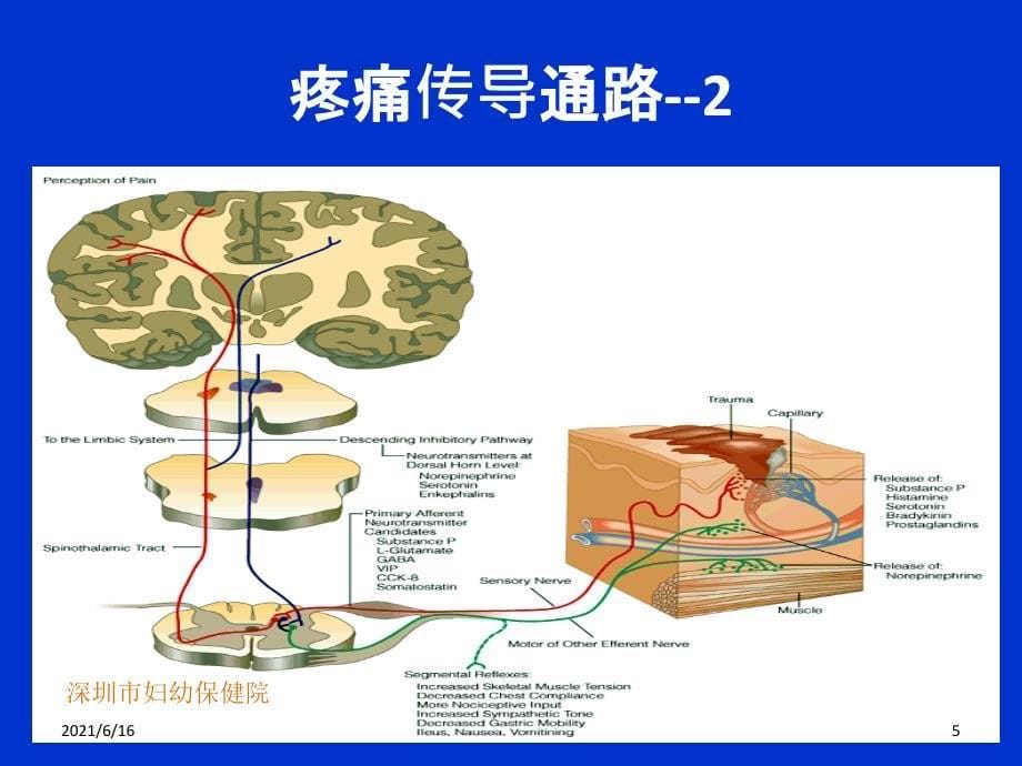 疼痛学概述_第5页