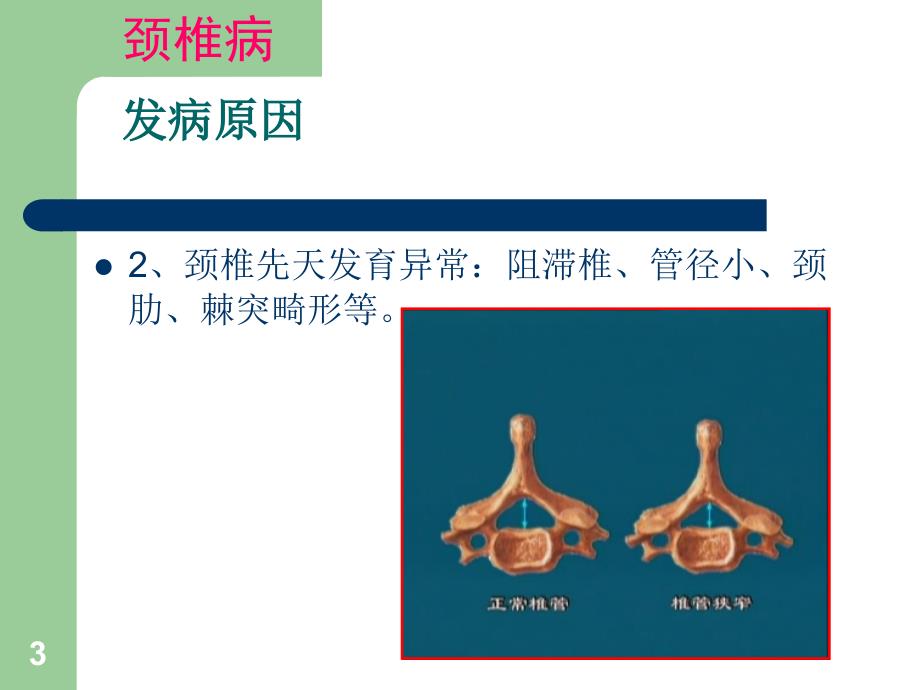 优质课件颈腰椎病的预防与自我保健_第3页