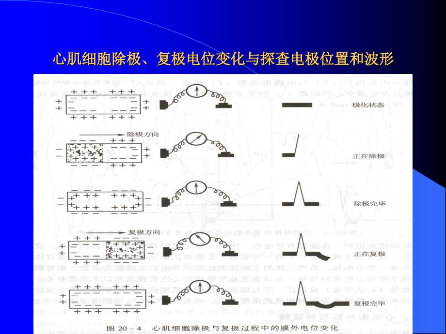 正常异常心电图汇总_第4页