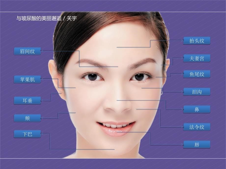 美容培训课件——玻尿酸.ppt_第5页