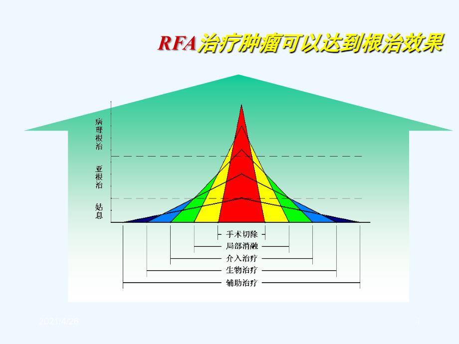 肺癌射频消融精品课件_第4页