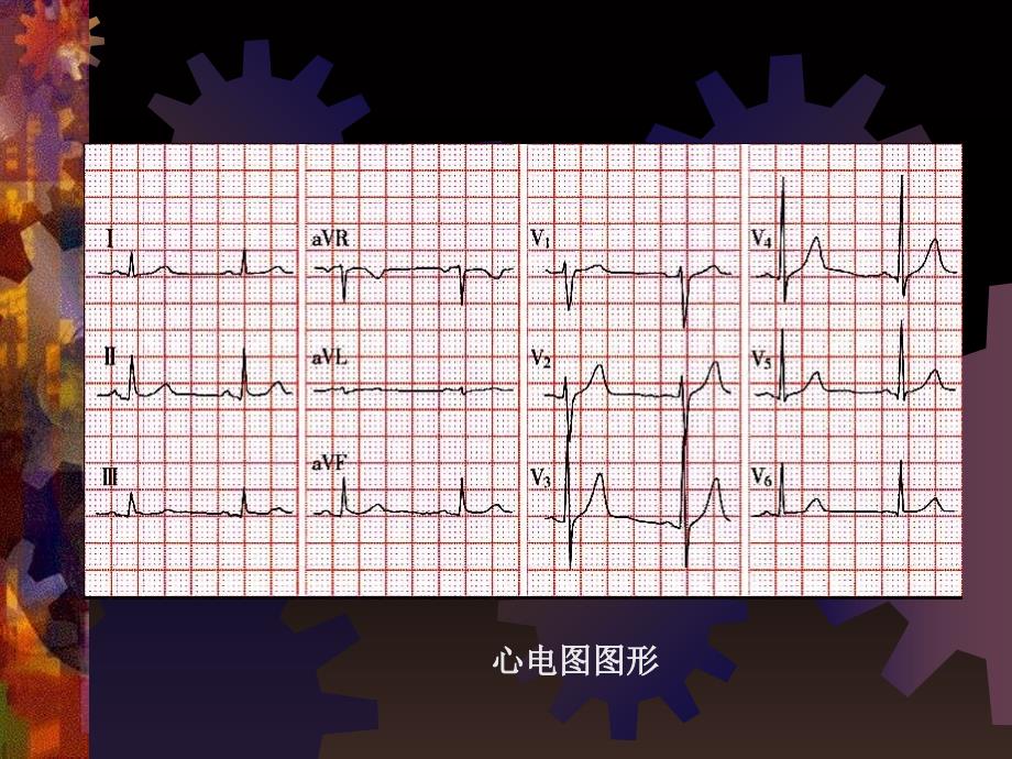 心电图的基本知识PPT课件_第4页