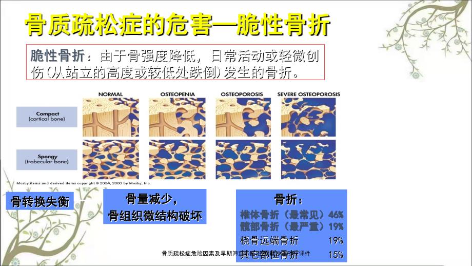 骨质疏松症危险因素及早期筛查诊断进展默沙东PPT课件_第4页