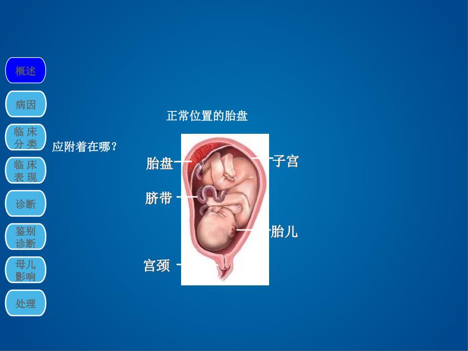 产科前置胎盘剖析_第3页