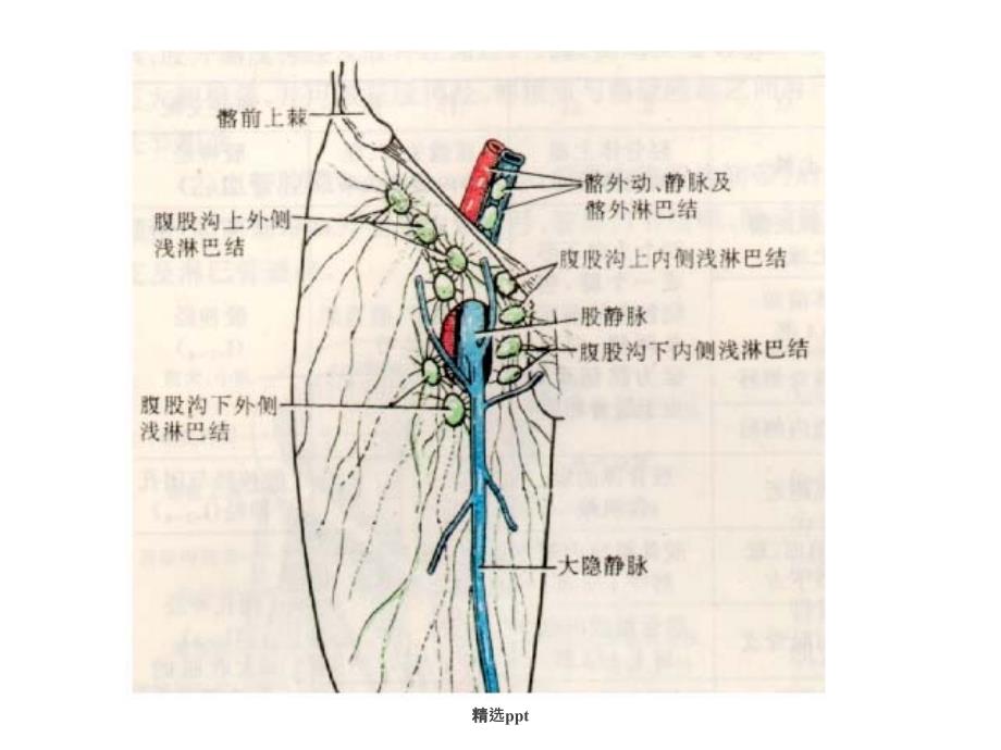 大隐静脉曲张的诊疗现状_第4页