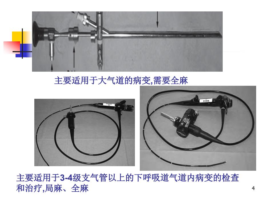 维支气管镜在儿ppt课件_第4页