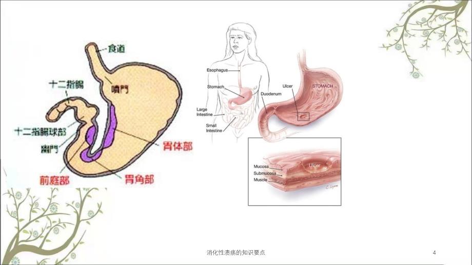 消化性溃疡的知识要点_第4页