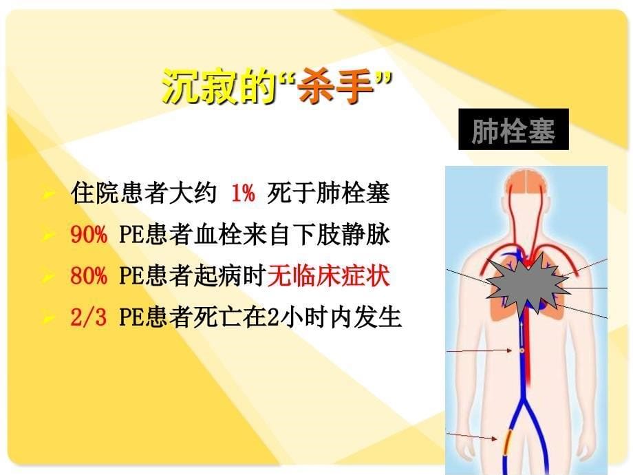 卧床患者深静脉血栓形成预防和护理.ppt_第5页