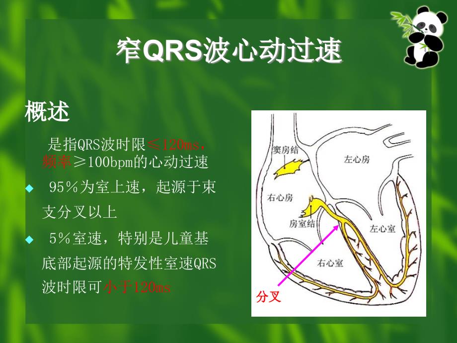 窄QRS波心动过速的诊断与鉴别诊断_第4页