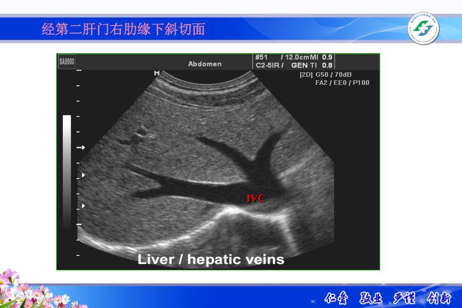 医学影像诊断学课件：超声示教_第4页