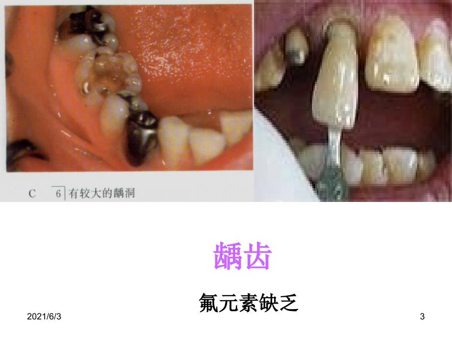 人教版初三化学课件初三化学化学元素与人体健康PPT课件_第3页