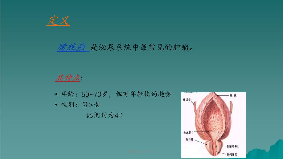 膀胱癌 业务学习课件_第2页