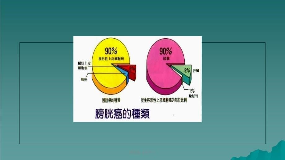 膀胱癌 业务学习课件_第5页