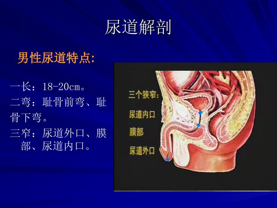 导尿及注意事项.课件_第3页