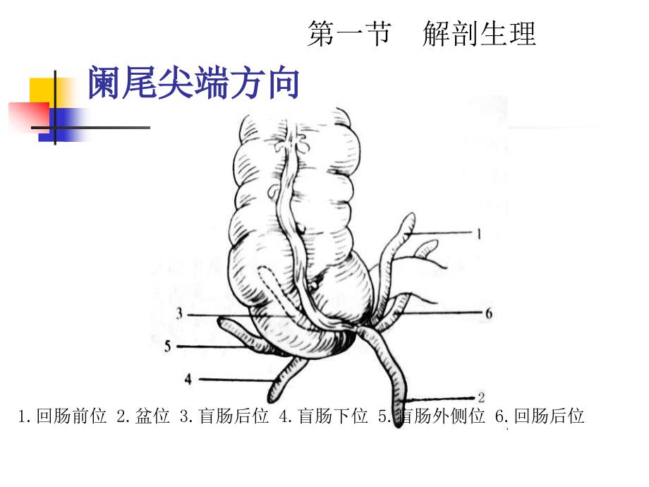 外科学教学课件暨南大学本科生大课急性阑尾炎_第3页