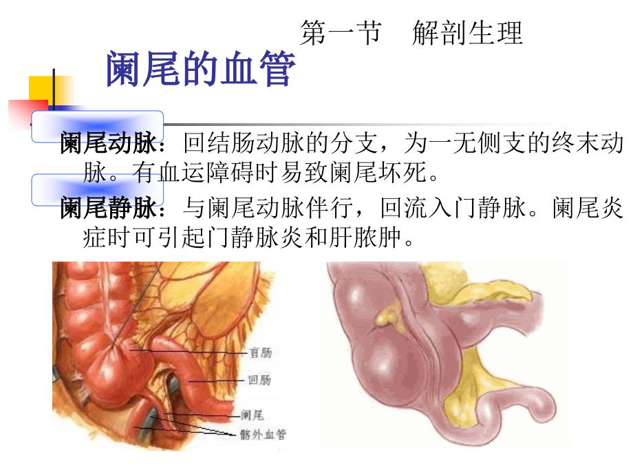 外科学教学课件暨南大学本科生大课急性阑尾炎_第4页