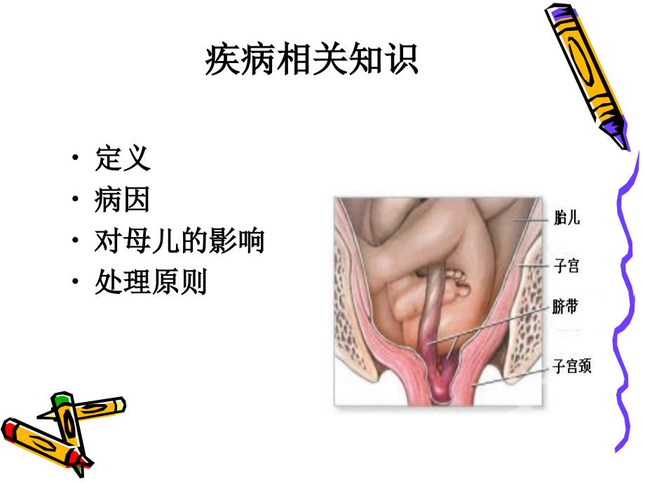 脐带脱垂护理查房_第3页