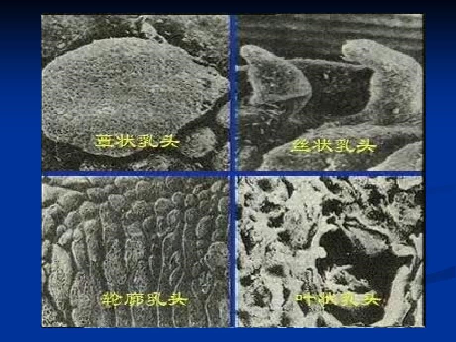 中医诊断学第三章舌诊_第5页