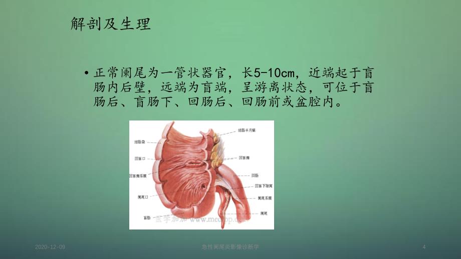 急性阑尾炎影像诊断学_第4页