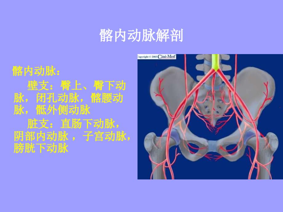 腹主髂动脉瘤腔内治疗_第4页