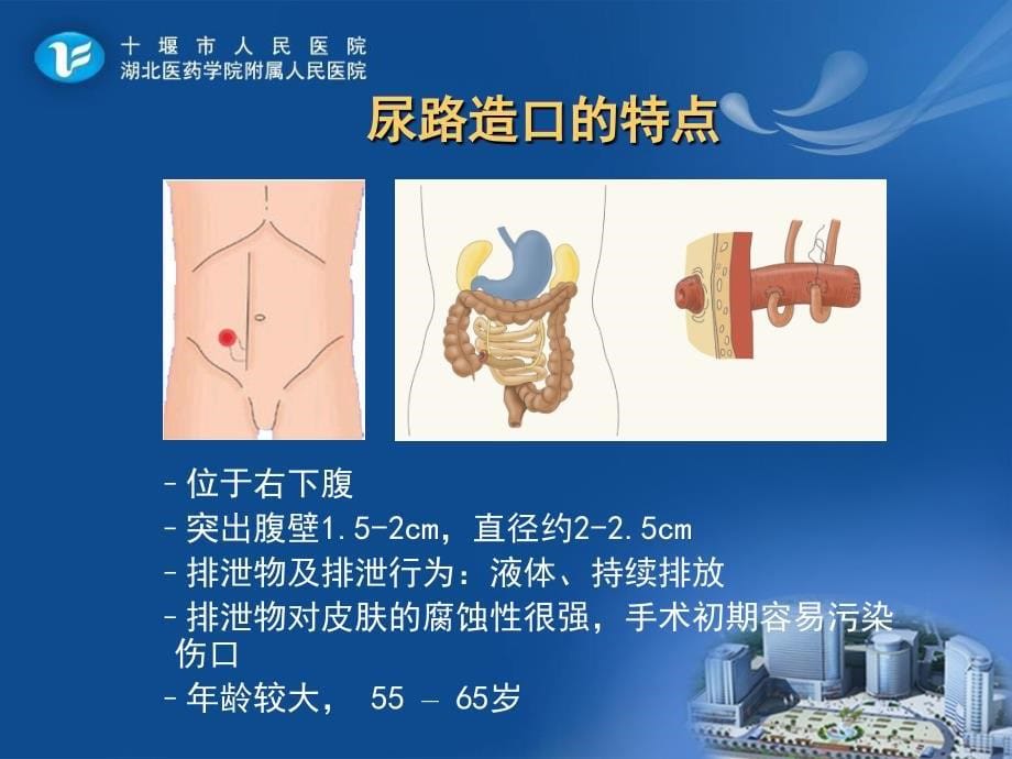 尿路造口的护理及管理PPT课件.ppt_第5页