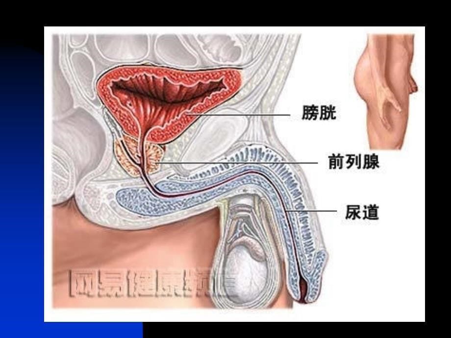 前列腺炎PROSTATITIS精品PPT课件_第5页