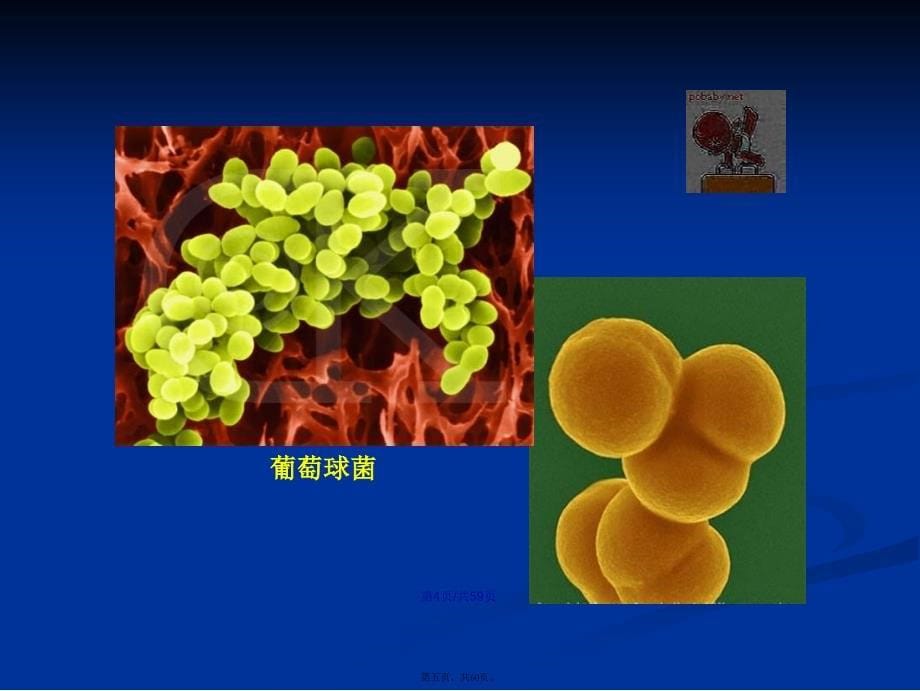 儿科护理学新生儿败血症学习教案_第5页