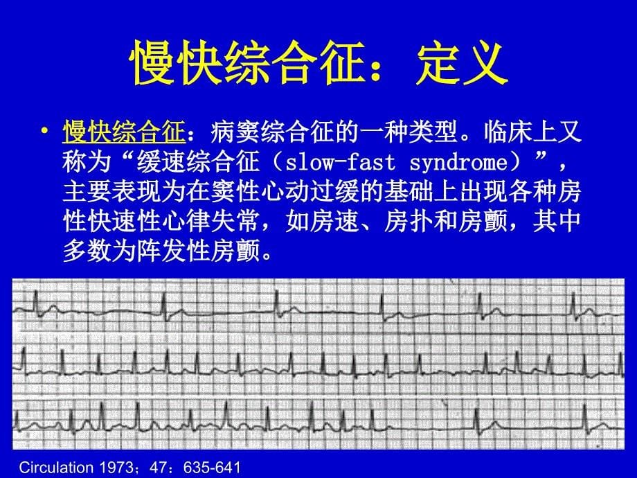 慢快综合征-VS-快慢综合征治疗策略选择_第5页