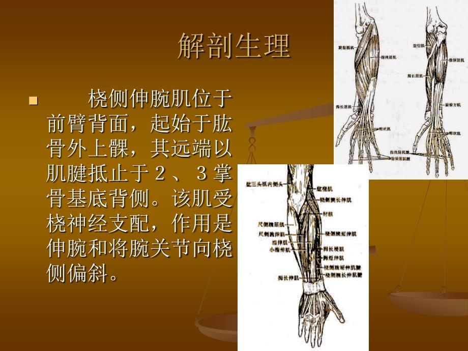 肱骨外上髁炎_第4页