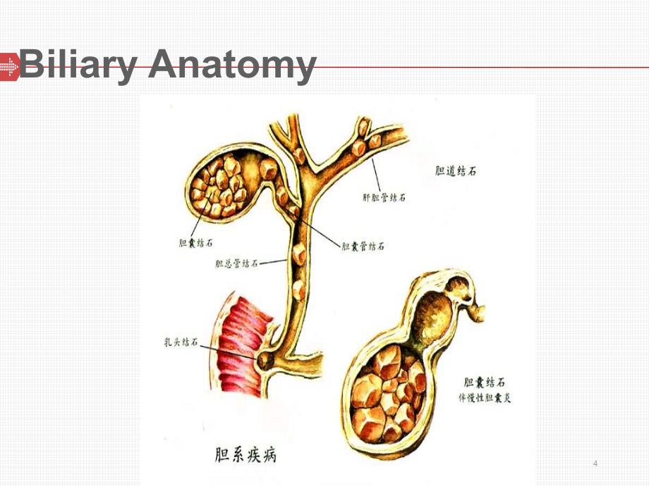 胆石症PPT课件_第4页