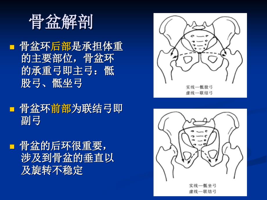 合并骶骨骨折的骨盆后环损伤的治疗2015省骨科年会_第3页