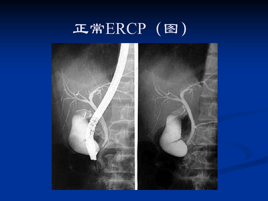 医学影像学：胆系先天性疾病_第3页