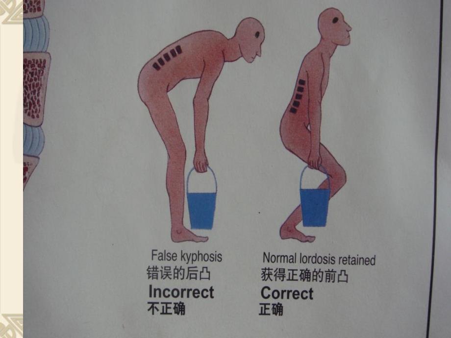 椎间盘突出的预防保健_第4页