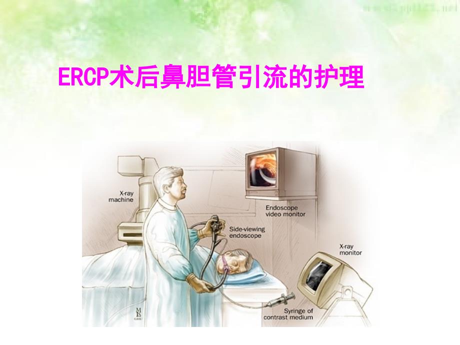 （优质课件）ERCP术后鼻胆管引流的护理_第1页