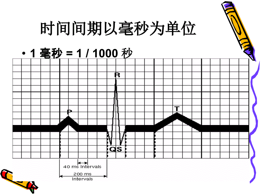 心脏起搏器心电图_第4页