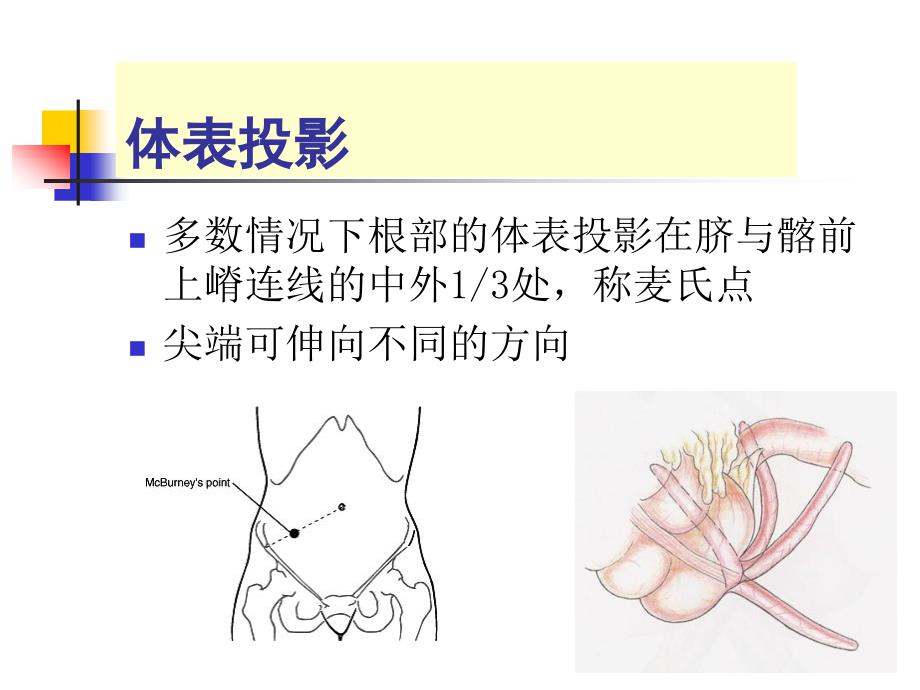 外科学教学课件：阑尾炎_第3页