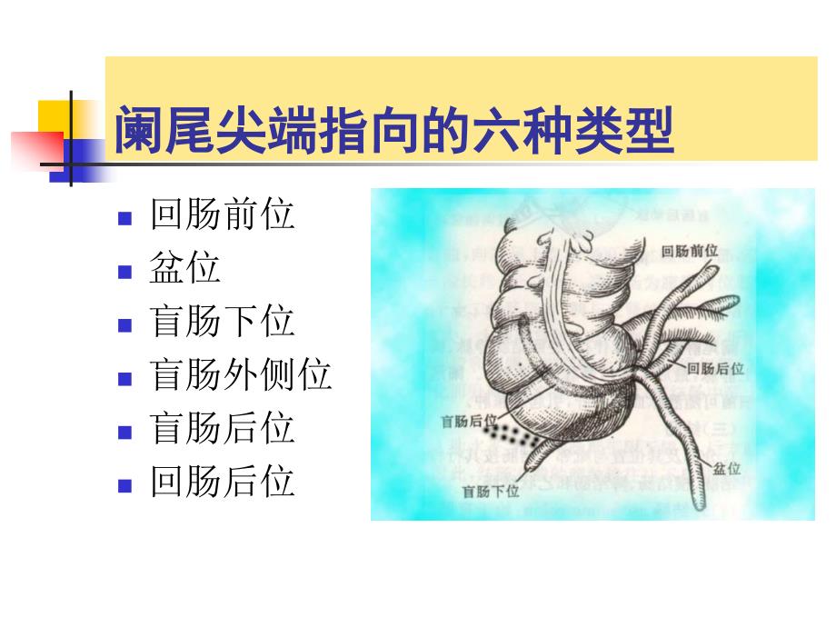 外科学教学课件：阑尾炎_第4页